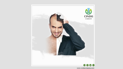 Hair Transplantation